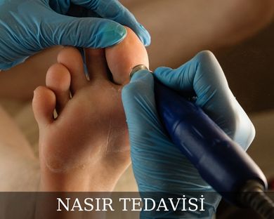 mersin nasır temizliği